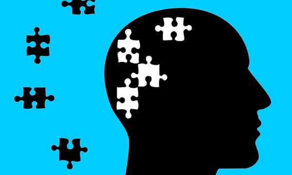 Alzheimers Elderly Brain